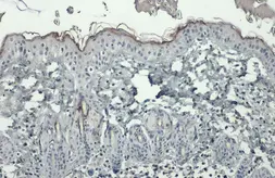 Anti-Filaggrin antibody used in IHC (Paraffin sections) (IHC-P). GTX37695